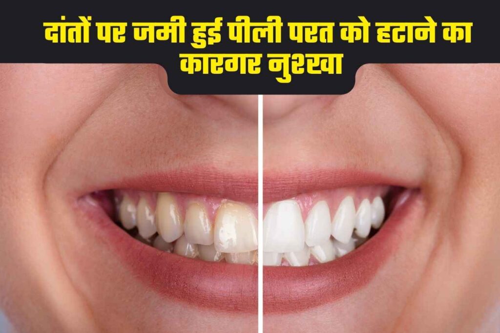Teeth Whitening Remedies: गोल्ड जैसे पीले दांतों को भी दूध जैसा सफेद बना देगा यह नुश्खा